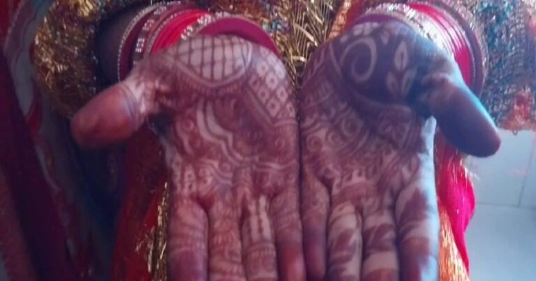 बिहार: हॉस्पिटल में स्पेशल शादी, हेल्थ वर्कर बने बराती और सराती,गाए गए मंगलगीत